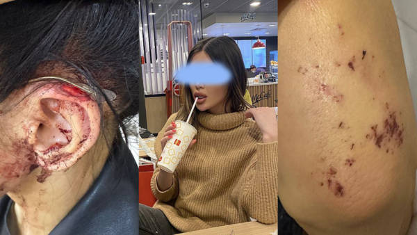 Избил и откусил ухо: в Алматы Трансгендер подозревается в нападении на женщину