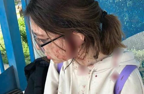 16-летнюю девушку избили две женщины на остановке в Боралдае